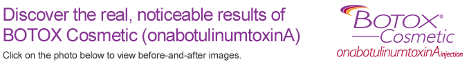 Results of Botox cosmetic